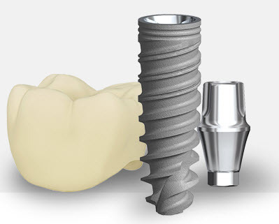 Dental Implants 